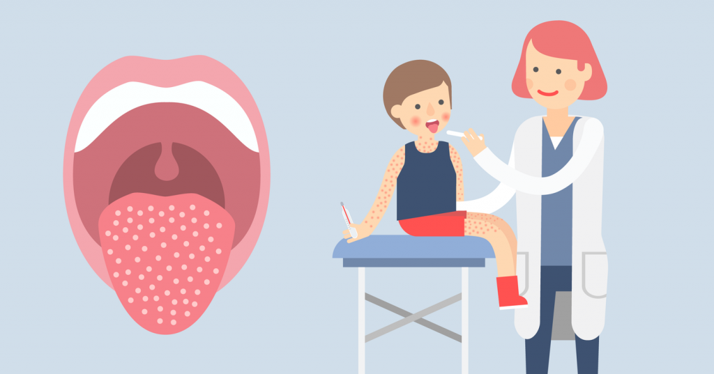 Мутация патогена скарлатины: новая угроза для здоровья